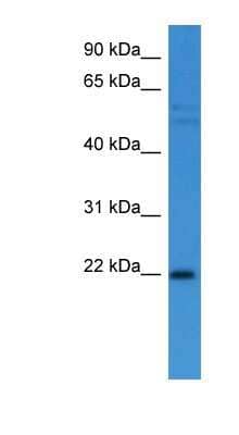 Western Blot: GADD45A Antibody [NBP1-79791] - Human Heart lysate, concentration 0.2-1 ug/ml.