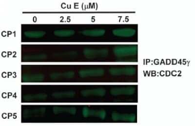 Western Blot: GADD45G Antibody (OTI2F12) [NBP2-45807] - GADD45G protein level by using anti-GADD45G antibody in human CRC cells.