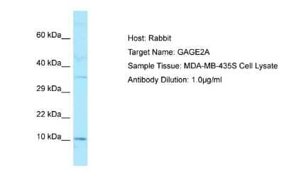 Western Blot GAGE-2A Antibody