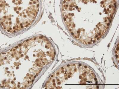 Immunohistochemistry-Paraffin: GAGE1 Antibody [H00002543-B01P] - Analysis of purified antibody to GAGE1 on formalin-fixed paraffin-embedded human testis. (antibody concentration 3 ug/ml)