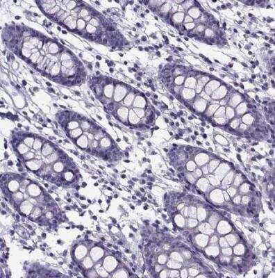 Immunohistochemistry-Paraffin: GAGE1 Antibody [NBP2-54704] - Staining of human colon shows no positivity in glandular cells as expected.