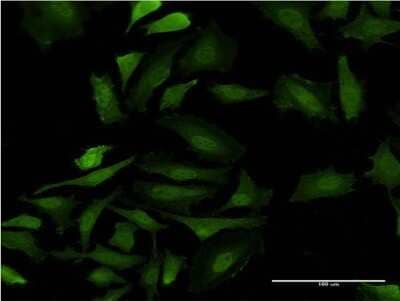 Immunocytochemistry/ Immunofluorescence GAGE5 Antibody (8F8)