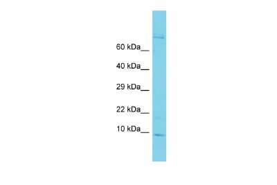 Western Blot: GAGE6 Antibody [NBP3-09602] - Western blot analysis of GAGE6 in ACHN Whole cell lysates. Antibody dilution at 1.0ug/ml