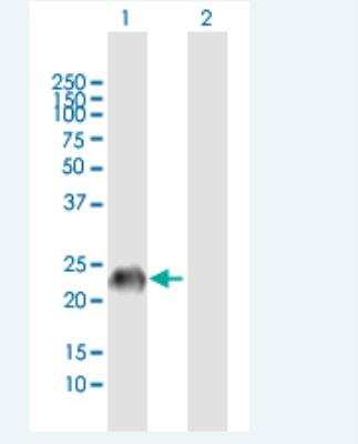 Western Blot GAGE7 Antibody