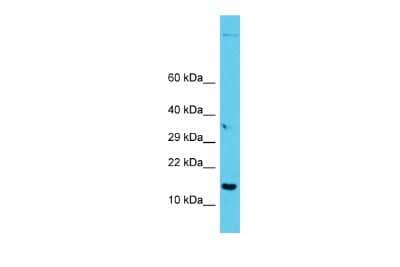 Western Blot GAGE7 Antibody