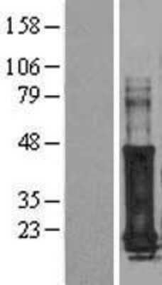 Western Blot GAGE7 Overexpression Lysate