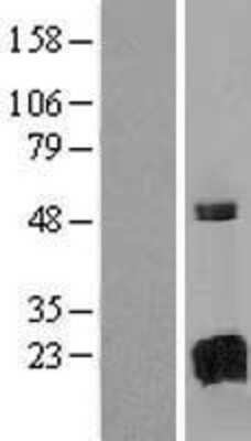 Western Blot GAGE8 Overexpression Lysate