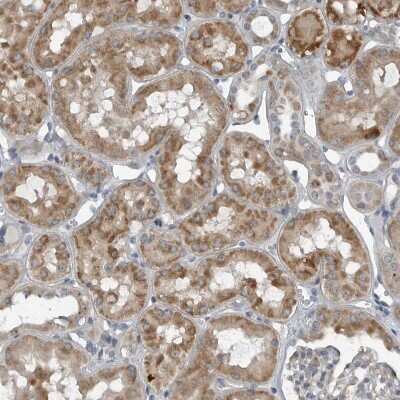 Immunohistochemistry-Paraffin GAK Antibody