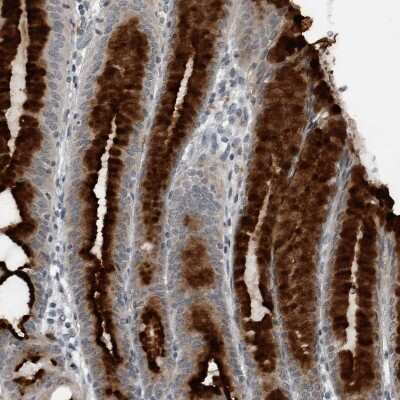 Immunohistochemistry-Paraffin GAK Antibody