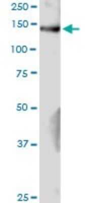 Western Blot: GAK Antibody [H00002580-D01P] - Analysis of GAK expression in mouse testis.