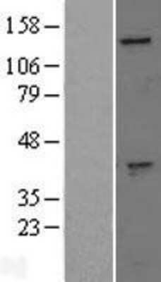 Western Blot: GAK Overexpression Lysate (Adult Normal) [NBL1-10941] Left-Empty vector transfected control cell lysate (HEK293 cell lysate); Right -Over-expression Lysate for GAK.