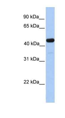 Western Blot GAL3ST3 Antibody