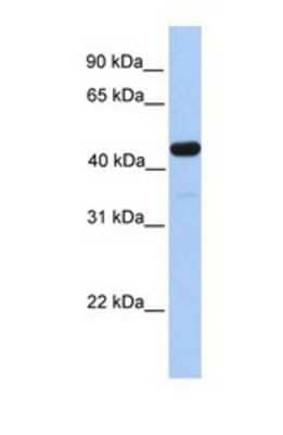 Western Blot: GAL3ST3 Antibody [NBP1-69307] - This Anti-GAL3ST3 antibody was used in Western Blot of Fetal Liver tissue lysate at a concentration of 1ug/ml.