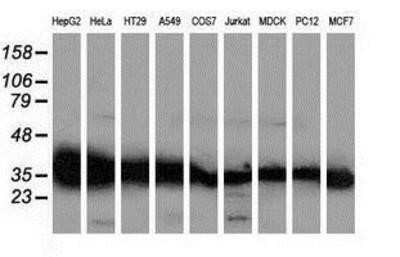 Western Blot: GALE Antibody (OTI1C4) - Azide and BSA Free [NBP2-70793] - Analysis of extracts (35ug) from 9 different cell lines by using anti-GALE monoclonal antibody (HepG2: human; HeLa: human; SVT2: mouse; A549: human; COS7: monkey; Jurkat: human; MDCK: canine; PC12: rat; MCF7: human).