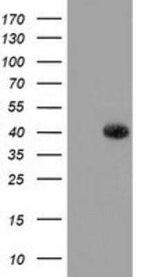 Western Blot: GALE Antibody (OTI1C4) - Azide and BSA Free [NBP2-70793] - HEK293T cells were transfected with the pCMV6-ENTRY control (Left lane) or pCMV6-ENTRY GALE (Right lane) cDNA for 48 hrs and lysed. Equivalent amounts of cell lysates (5 ug per lane) were separated by SDS-PAGE and immunoblotted with anti-GALE.