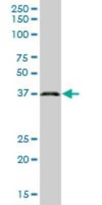 Western Blot: GALE Antibody [H00002582-B01P] - Analysis of GALE expression in human colon.