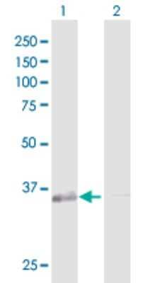 Western Blot: GALE Antibody [H00002582-D01P] - Analysis of GALE expression in transfected 293T cell line by GALE polyclonal antibody.Lane 1: GALE transfected lysate(38.30 KDa).Lane 2: Non-transfected lysate.