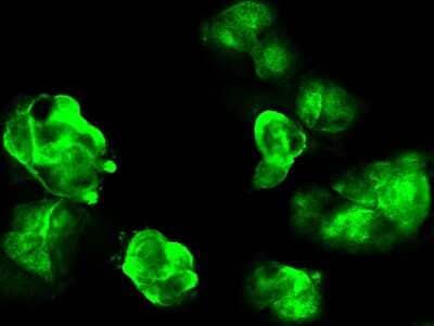 <b>Genetic Strategies Validation. </b>Immunocytochemistry/Immunofluorescence: GALK1 Antibody [NBP2-99783] - Immunofluorescence staining of HG3C-GALK1 in MCF7 cells. Cells were fixed with 4% PFA, permeabilzed with 0.3% Triton X-100 in PBS, blocked with 10% serum, and incubated with rabbit anti- HG3C-GALK1 polyclonal antibody (dilution ratio: 1:1000) at 4C overnight. Then cells were stained with the Alexa Fluor(R)488-conjugated Goat Anti-rabbit IgG secondary antibody (green).Positive staining was localized to cytoplasm.