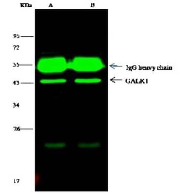 Immunoprecipitation: GALK1 Antibody [NBP2-99783] - GALK1 was immunoprecipitated using: Lane A: 0.5 mg Hela Whole Cell Lysate Lane B: 0.5 mg HepG2 Whole Cell Lysate 4 ul anti-GALK1 rabbit polyclonal antibody and 15 ul of 50 % Protein G agarose.  Primary antibody: Anti-GALK1 rabbit polyclonal antibody, at 1:100 dilution. Secondary antibody: Dylight 800-labeled antibody to rabbit IgG (H+L), at 1:5000 dilution  Developed using the Odyssey technique. Performed under reducing conditions. Predicted band size: 42 kDa. Observed band size: 42 kDa