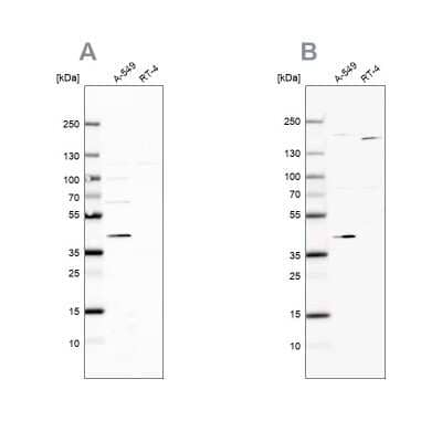 Western Blot: GALK1 Antibody [NBP1-81854] - Analysis using Anti-GALK1 antibody NBP1-81854 (A) shows similar pattern to independent antibody NBP1-81853 (B).