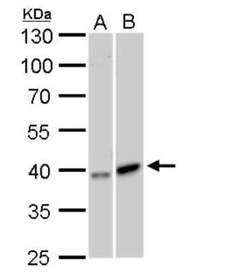 Western Blot: GALK1 Antibody [NBP2-16591] - A. 30 ug Huh7 whole cell lysate/extract  B. 30 ug HepG2 whole cell lysate/extract 10 % SDS-PAGE GALK1 antibody dilution: 1:1000