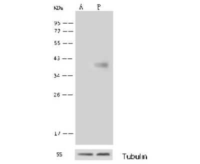 Western Blot: GALK1 Antibody [NBP2-99783] - Anti-GALK1 rabbit polyclonal antibody at 1:500 dilution. Lane A: GALK1 knockout Hela Whole Cell Lysate Lane B: Hela Whole Cell Lysate Lysates/proteins at 10 ug per lane. Secondary Goat Anti-Rabbit IgG (H+L)/HRP at 1/10000 dilution. Developed using the ECL technique. Performed under reducing conditions. Predicted band size: 42 kDa. Observed band size: 42 kDa