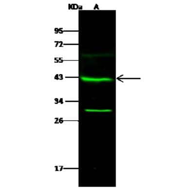 Western Blot: GALK1 Antibody [NBP2-99783] - Anti-GALK1 rabbit polyclonal antibody at 1:500 dilution. Lane A: HeLa Whole Cell Lysate Lysates/proteins at 30 ug per lane. Secondary Goat Anti- Rabbit IgG H&L (Dylight 800) at 1/10000 dilution. Developed using the Odyssey technique. Performed under reducing conditions. Predicted band size: 42 kDa. Observed band size: 42 kDa (We are unsure as to the identity of these extra bands).