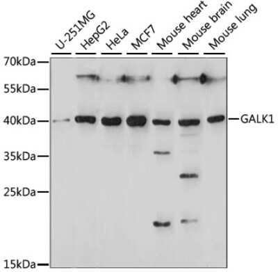 Western Blot: GALK1 Antibody [NBP3-04421] - Analysis of extracts of various cell lines, using GALK1 antibody at 1:1000 dilution. Secondary antibody: HRP Goat Anti-Rabbit IgG (H+L) at 1:10000 dilution. Lysates/proteins: 25ug per lane. Blocking buffer: 3% nonfat dry milk in TBST. Detection: ECL Basic Kit