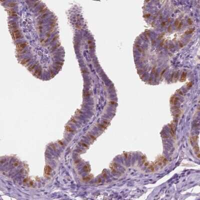 Immunohistochemistry: GALM Antibody [NBP2-38252] - Staining of human fallopian tube shows moderate cytoplasmic and nuclear positivity in glandular cells.