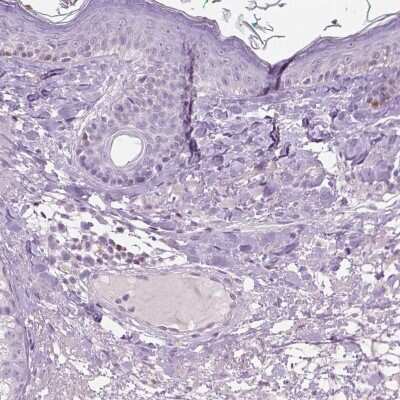 Immunohistochemistry-Paraffin: GALM Antibody [NBP1-85906] - Staining of human skin shows low expression as expected.