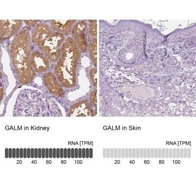 <b>Orthogonal Strategies Validation. </b>Immunohistochemistry-Paraffin: GALM Antibody [NBP1-85906] - Staining in human kidney and skin tissues using anti-GALM antibody. Corresponding GALM RNA-seq data are presented for the same tissues.