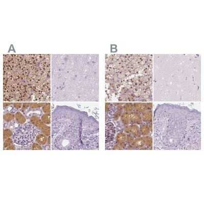 <b>Independent Antibodies Validation. </b>Immunohistochemistry-Paraffin: GALM Antibody [NBP1-85906] - Staining of human adrenal gland, cerebral cortex, kidney and skin using Anti-GALM antibody NBP1-85906 (A) shows similar protein distribution across tissues to independent antibody NBP2-38252 (B).