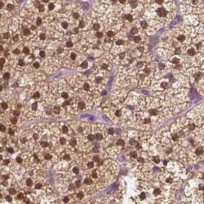 Immunohistochemistry-Paraffin: GALM Antibody [NBP1-85906] - Staining of human adrenal gland.