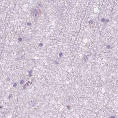 Immunohistochemistry-Paraffin: GALM Antibody [NBP1-85906] - Staining of human cerebral cortex.