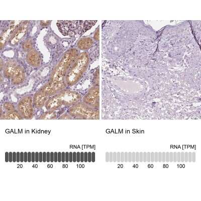 Immunohistochemistry-Paraffin: GALM Antibody [NBP2-38252] - Staining in human kidney and skin tissues using anti-GALM antibody. Corresponding GALM RNA-seq data are presented for the same tissues.