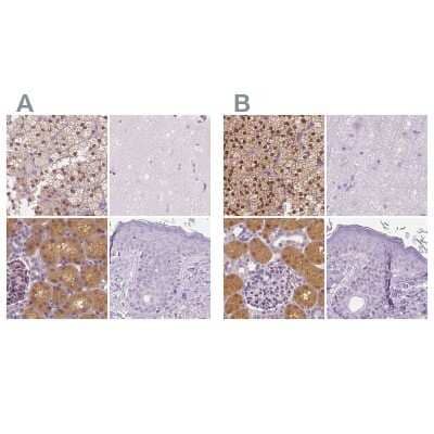 Immunohistochemistry-Paraffin: GALM Antibody [NBP2-38252] - Staining of human adrenal gland, cerebral cortex, kidney and skin using Anti-GALM antibody NBP2-38252 (A) shows similar protein distribution across tissues to independent antibody NBP1-85906 (B).