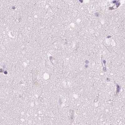 Immunohistochemistry-Paraffin: GALM Antibody [NBP2-38252] - Staining of human cerebral cortex.