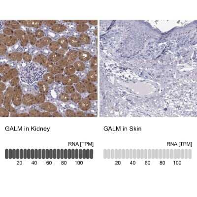 <b>Orthogonal Strategies Validation. </b>Immunohistochemistry-Paraffin: GALM Antibody [NBP2-62645] - Immunohistochemistry analysis in human kidney and skin tissues using Anti-GALM antibody. Corresponding GALM RNA-seq data are presented for the same tissues.