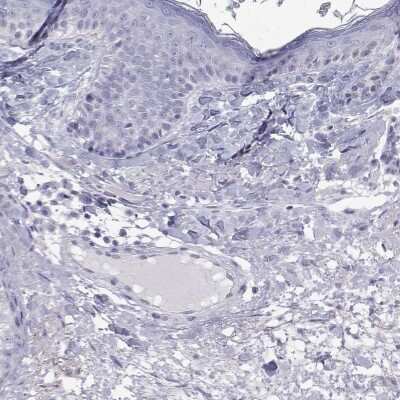 Immunohistochemistry-Paraffin: GALM Antibody [NBP2-62645] - Staining of human skin shows low expression as expected.