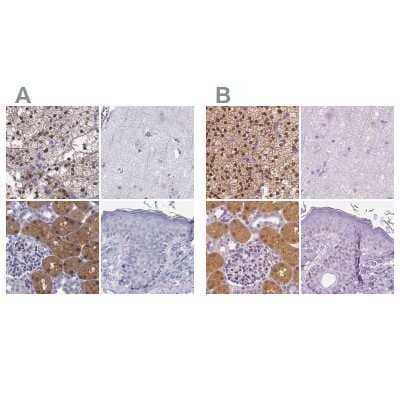 <b>Independent Antibodies Validation. </b>Immunohistochemistry-Paraffin: GALM Antibody [NBP2-62645] - Staining of human adrenal gland, cerebral cortex, kidney and skin using Anti-GALM antibody NBP2-62645 (A) shows similar protein distribution across tissues to independent antibody NBP1-85906 (B).