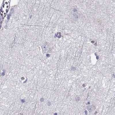 Immunohistochemistry-Paraffin: GALM Antibody [NBP2-62645] - Staining of human cerebral cortex.