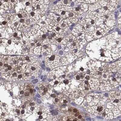 Immunohistochemistry-Paraffin: GALM Antibody [NBP2-62645] - Staining of human adrenal gland.