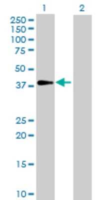 Western Blot: GALM Antibody [H00130589-B01P] - Analysis of GALM expression in transfected 293T cell line by GALM polyclonal antibody.  Lane 1: GALM transfected lysate(37.62 KDa). Lane 2: Non-transfected lysate.