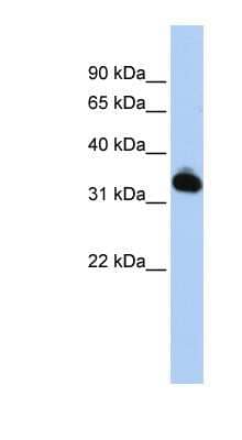 Western Blot: GALM Antibody [NBP1-56713] - HepG2 cell lysate, concentration 0.2-1 ug/ml.