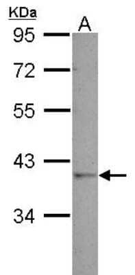 Western Blot: GALM Antibody [NBP2-16592] - Sample (30 ug of whole cell lysate) A: 293T 10% SDS PAGE gel, diluted at 1:1000.