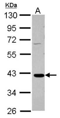 Western Blot: GALM Antibody [NBP2-16593] - Sample (30 ug of whole cell lysate) A: HepG2 10% SDS PAGE gel, diluted at 1:1000.