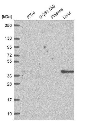 Western Blot: GALM Antibody [NBP2-62645] - Analysis in human cell line RT-4, human cell line U-251 MG, human plasma and human liver tissue.