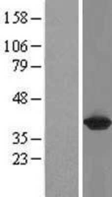 Western Blot: GALM Overexpression Lysate (Adult Normal) [NBL1-10950] Left-Empty vector transfected control cell lysate (HEK293 cell lysate); Right -Over-expression Lysate for GALM.