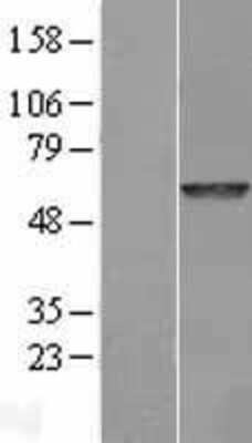 Western Blot: GALNS Overexpression Lysate (Adult Normal) [NBL1-10952] Left-Empty vector transfected control cell lysate (HEK293 cell lysate); Right -Over-expression Lysate for GALNS.