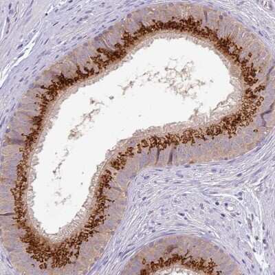 Immunohistochemistry-Paraffin: GALNT12 Antibody [NBP2-14035] - Staining of human epididymis shows high expression.